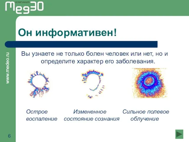 Он информативен! Вы узнаете не только болен человек или нет, но и