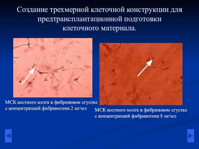 Создание трехмерной клеточной конструкции для предтрансплантационной подготовки клеточного материала. МСК костного мозга