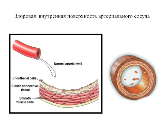 Здоровая внутренняя поверхность артериального сосуда