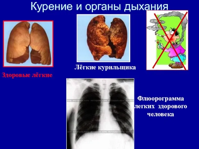 Здоровые лёгкие Лёгкие курильщика Флюорограмма легких здорового человека Курение и органы дыхания