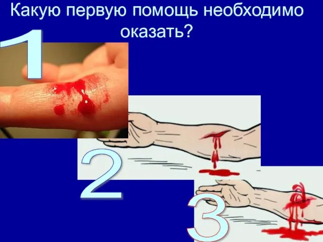 Какую первую помощь необходимо оказать? 1 2 3