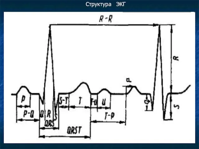 Структура ЭКГ