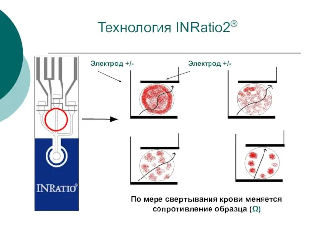 Технология INRatio2® Электрод +/- Электрод +/- По мере свертывания крови меняется сопротивление образца (Ω)