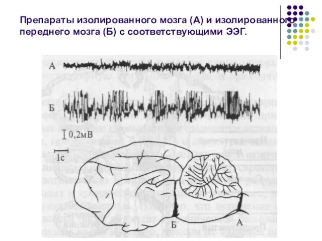 Препараты изолированного мозга (А) и изолированного переднего мозга (Б) с соответствующими ЭЭГ.