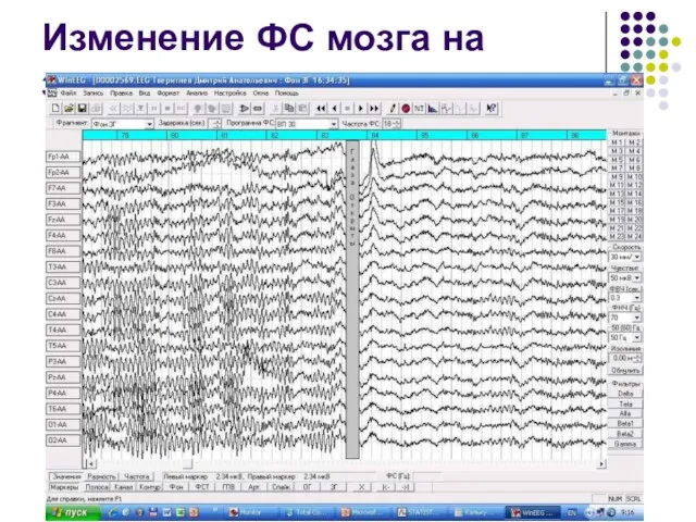 Изменение ФС мозга на закрывание глаз