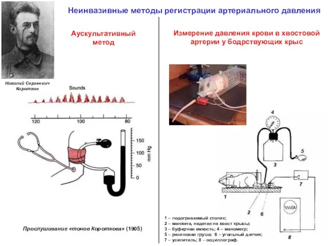 Неинвазивные методы регистрации артериального давления Аускультативный метод Прослушивание «тонов Короткова» (1905) 1