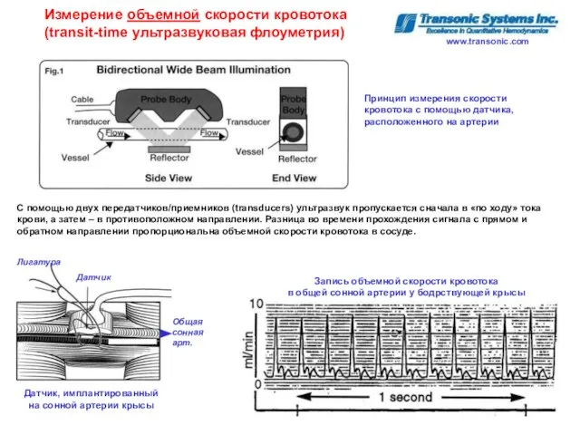 Измерение объемной скорости кровотока (transit-time ультразвуковая флоуметрия) Датчик, имплантированный на сонной артерии