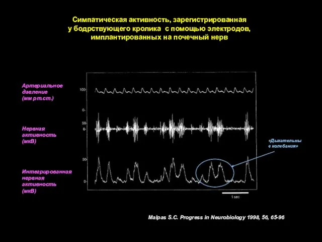 Артериальное давление (мм рт.ст.) Нервная активность (мкВ) Интегрированная нервная активность (мкВ) Симпатическая