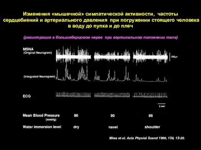 Изменения «мышечной» симпатической активности, частоты сердцебиений и артериального давления при погружении стоящего