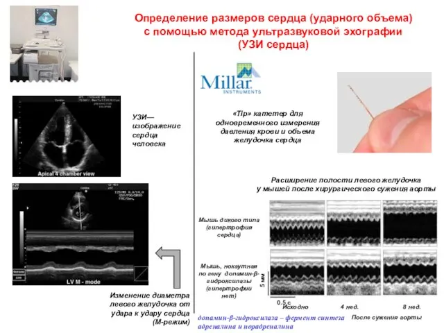 Определение размеров сердца (ударного объема) с помощью метода ультразвуковой эхографии (УЗИ сердца)