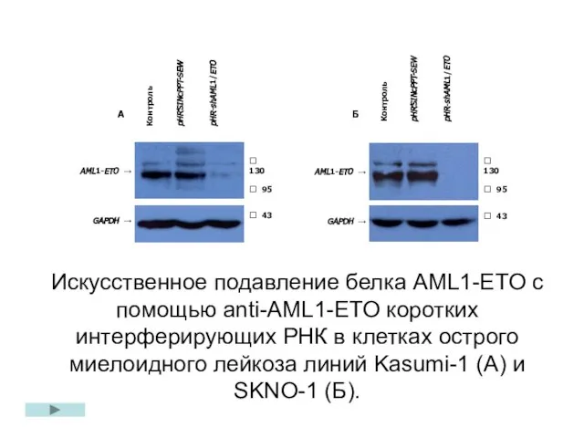 Искусственное подавление белка AML1-ETO с помощью anti-AML1-ETO коротких интерферирующих РНК в клетках