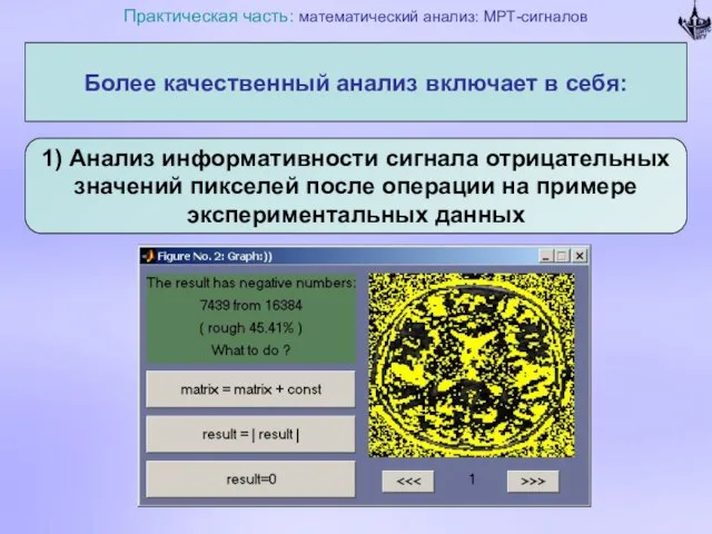 Практическая часть: математический анализ: МРТ-сигналов Более качественный анализ включает в себя: 1)