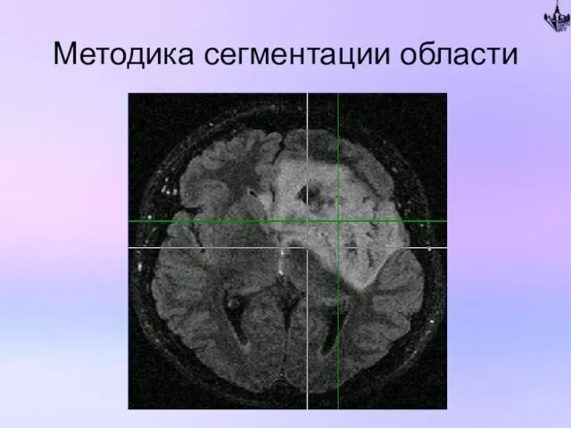 Методика сегментации области