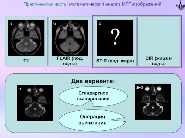 T2 Практическая часть: математический анализ МРТ-изображений FLAIR (под. воды) DIR (жира и