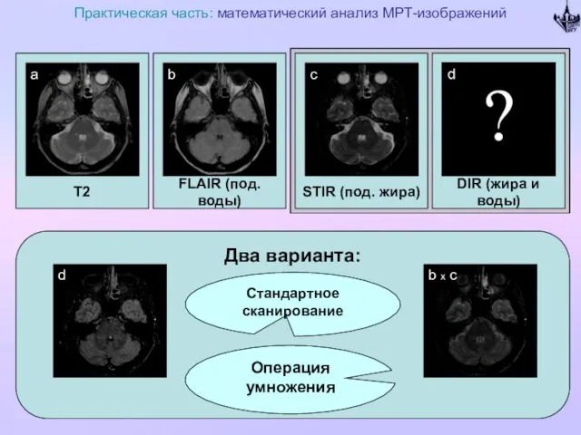 T2 Практическая часть: математический анализ МРТ-изображений FLAIR (под. воды) DIR (жира и