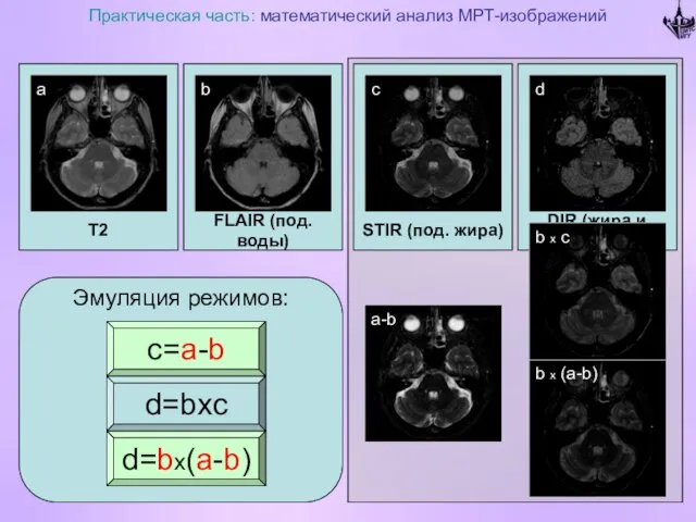 T2 Практическая часть: математический анализ МРТ-изображений FLAIR (под. воды) DIR (жира и