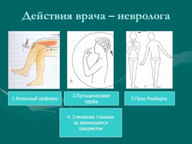 Действия врача – невролога 4. Слежение глазами за движущимся предметом 3.Поза Ронберга. 2.Пальценосовая проба 1.Коленный рефлекс