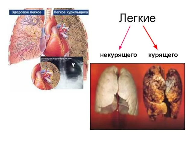 Легкие некурящего курящего