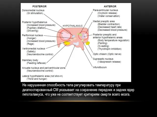 Не нарушенная способность тела регулировать температуру при диагностированный СМ указывает на сохранение