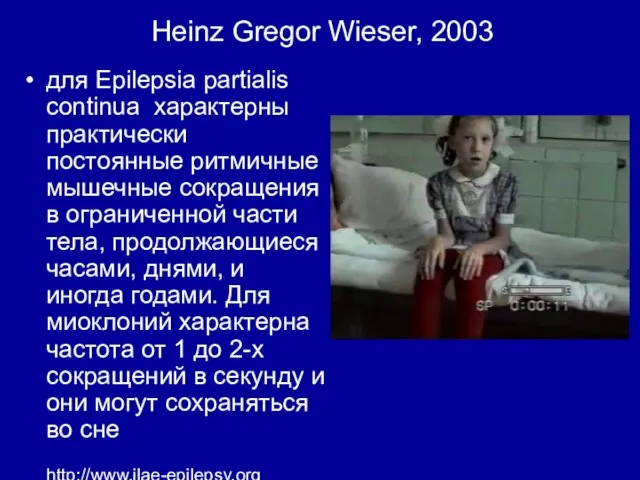 Heinz Gregor Wieser, 2003 для Epilepsia partialis continua характерны практически постоянные ритмичные