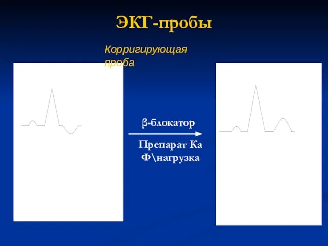 ЭКГ-пробы Корригирующая проба β-блокатор Препарат Ка Ф\нагрузка