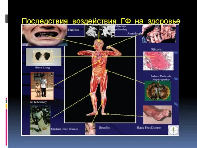 Последствия воздействия ГФ на здоровье