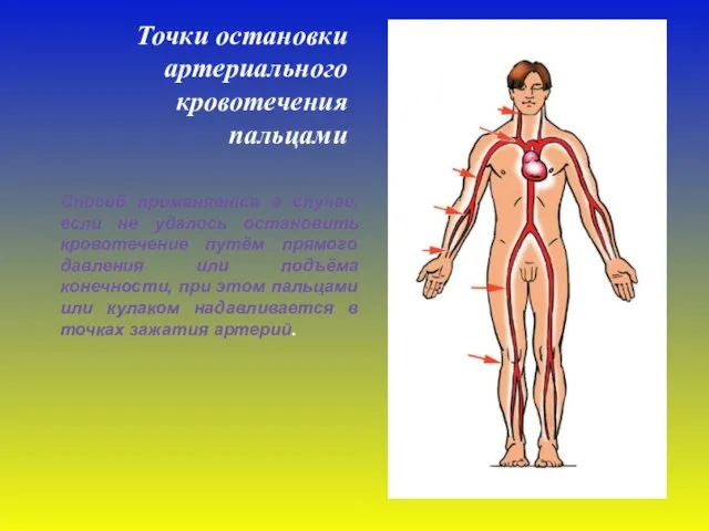 Точки остановки артериального кровотечения пальцами Способ применяется в случае, если не удалось