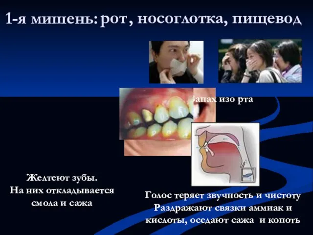 1-я мишень: Голос теряет звучность и чистоту Раздражают связки аммиак и кислоты,