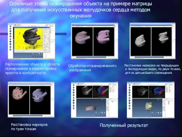 Основные этапы сканирования объекта на примере матрицы для получения искусственных желудочков сердца