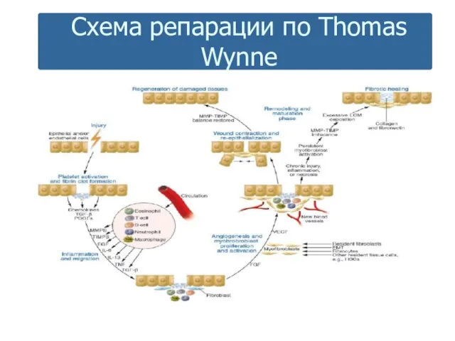 Схема репарации по Thomas Wynne