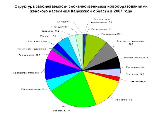 Структура заболеваемости злокачественными новообразованиями женского населения Калужской области в 2007 году