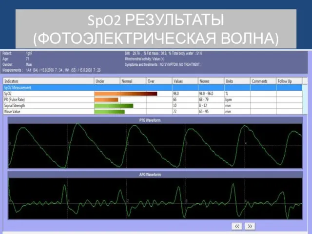 SpO2 РЕЗУЛЬТАТЫ (ФОТОЭЛЕКТРИЧЕСКАЯ ВОЛНА)