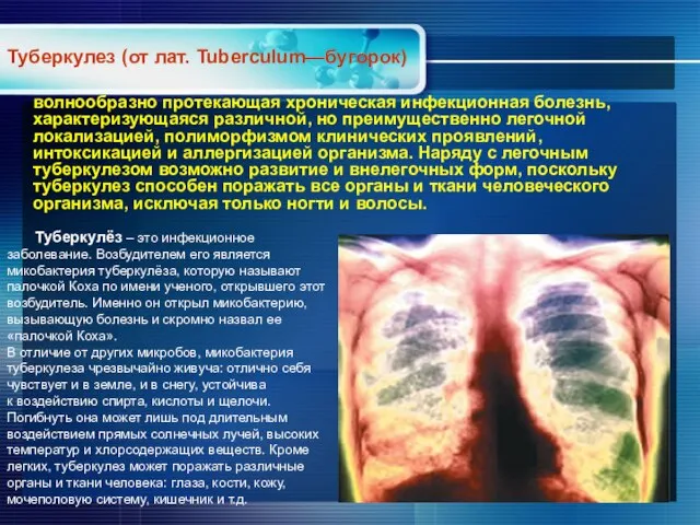 волнообразно протекающая хроническая инфекционная болезнь, характеризующаяся различной, но преимущественно легочной локализацией, полиморфизмом