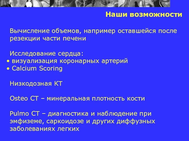 Наши возможности Вычисление объемов, например оставшейся после резекции части печени Исследование сердца: