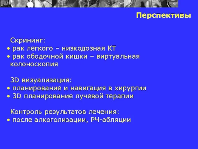 Перспективы Скрининг: рак легкого – низкодозная КТ рак ободочной кишки – виртуальная