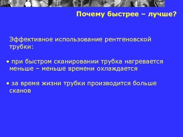 Почему быстрее – лучше? Эффективное использование рентгеновской трубки: при быстром сканировании трубка