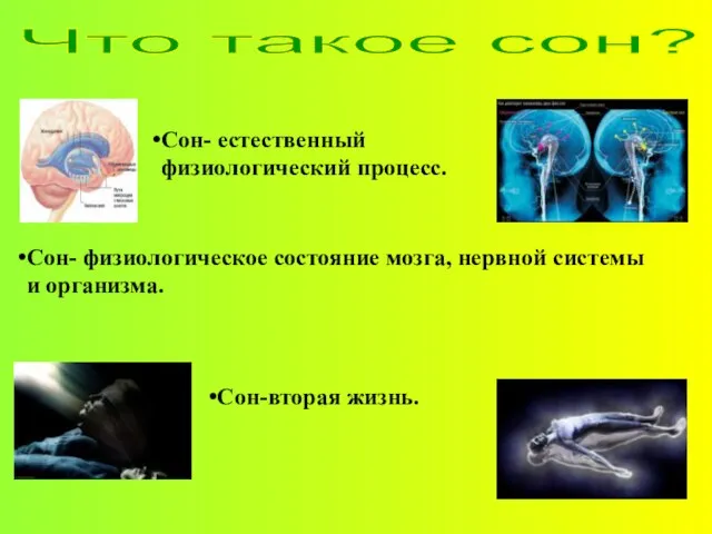 Сон- физиологическое состояние мозга, нервной системы и организма. Что такое сон? Сон-