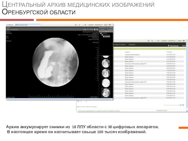 Центральный архив медицинских изображений Оренбургской области Архив аккумулирует снимки из 18 ЛПУ