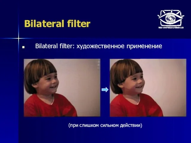 Bilateral filter Bilateral filter: художественное применение (при слишком сильном действии)