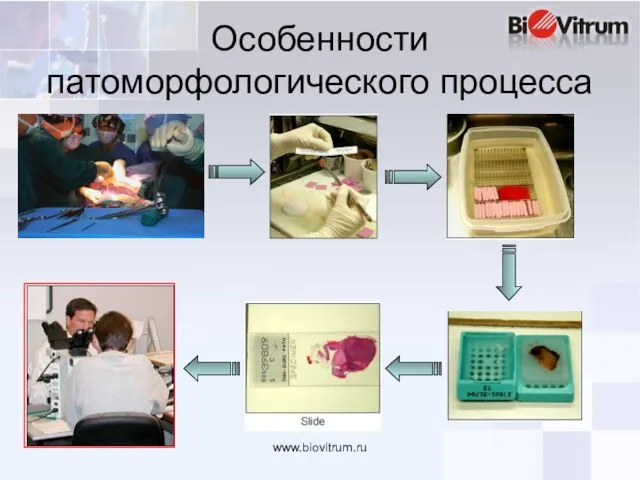 www.biovitrum.ru Особенности патоморфологического процесса