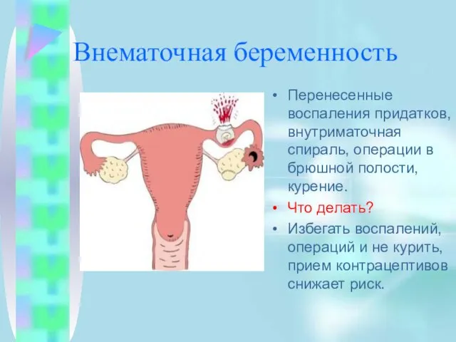 Внематочная беременность Перенесенные воспаления придатков, внутриматочная спираль, операции в брюшной полости, курение.