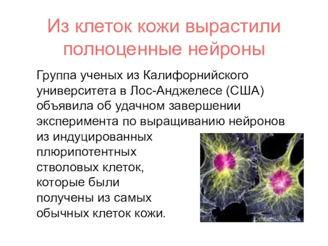 Из клеток кожи вырастили полноценные нейроны Группа ученых из Калифорнийского университета в