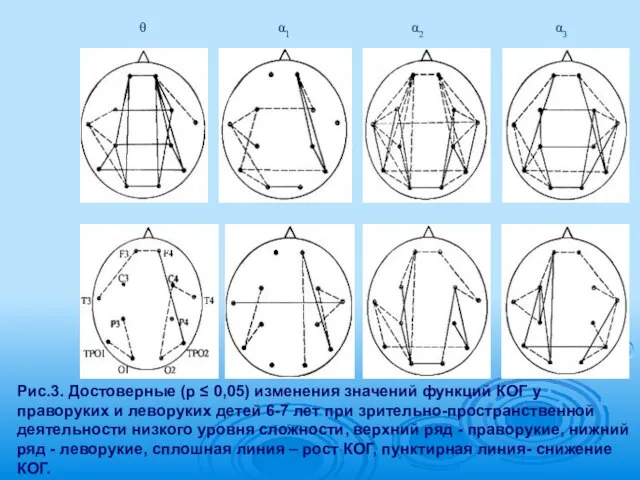 Рис.3. Достоверные (р ≤ 0,05) изменения значений функций КОГ у праворуких и