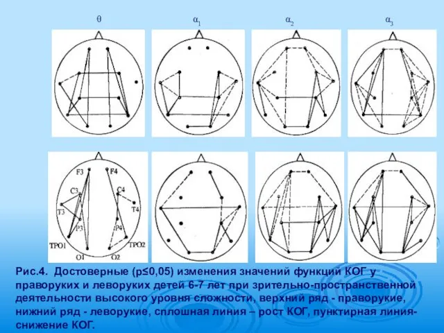 Рис.4. Достоверные (р≤0,05) изменения значений функций КОГ у праворуких и леворуких детей