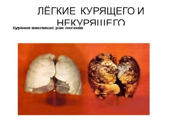 ЛЁГКИЕ КУРЯЩЕГО И НЕКУРЯЩЕГО