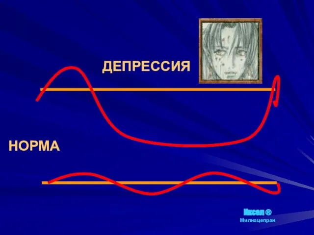 НОРМА ДЕПРЕССИЯ Иксел ® Милнацепран