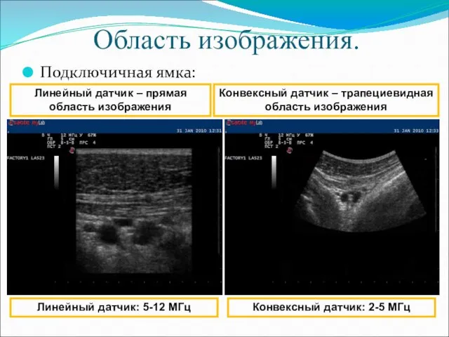 Область изображения. Подключичная ямка: Линейный датчик – прямая область изображения Конвексный датчик