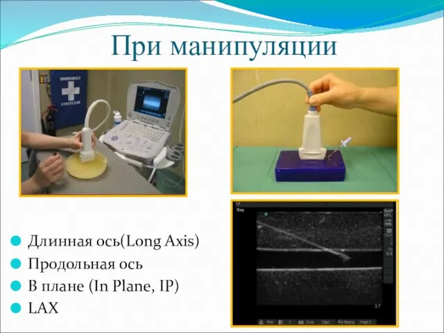 При манипуляции Длинная ось(Long Axis) Продольная ось В плане (In Plane, IP) LAX