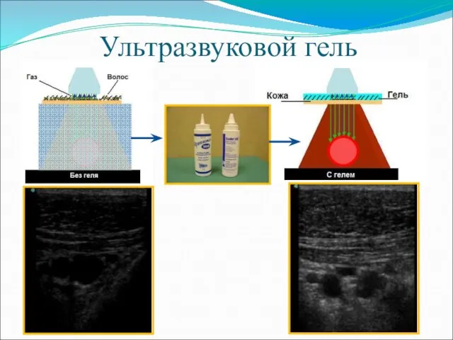 Ультразвуковой гель