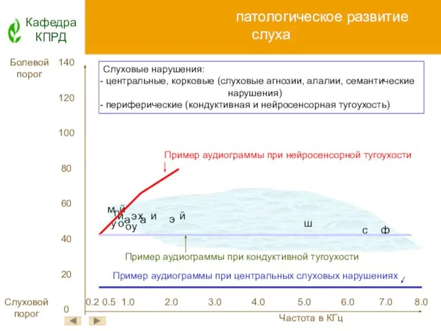 Нормальное и патологическое развитие слуха Кафедра КПРД 140 120 100 80 60